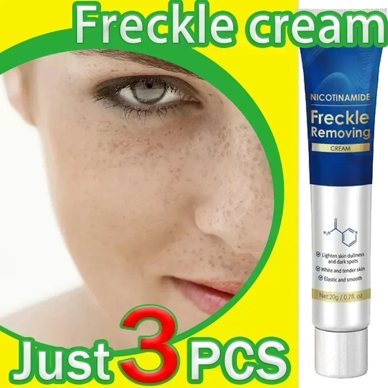 Face Skin Care Whitening Freckle Cream Remove Melasma Dark Spots Melanin Anti-Aging Lightening Shrink Pores Moisturizing