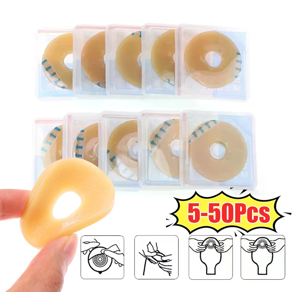5-50Pcs Portable 2/4mm Colostomy Bags Anti-leak Ring For Stoma Bags Supplies Protective Barrier Rings Ostomy Bag Assistance