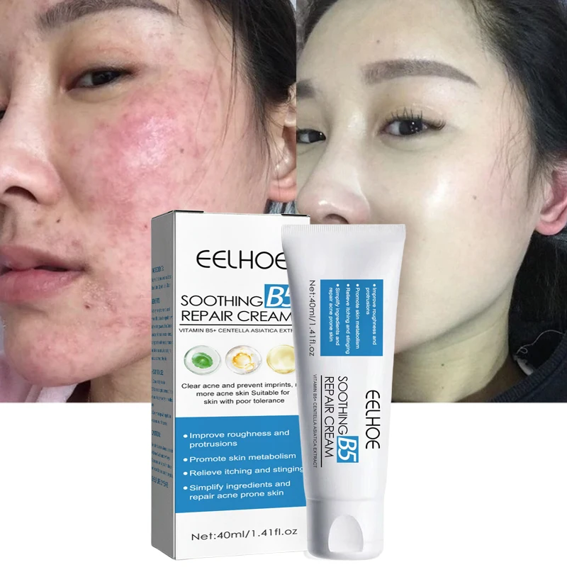 Cicaplast Repair Cream B5 Moisturizer Repair Cream Soothes Redness Itching Nourishes Improve Repair Sensitive Skin Sunscreen 40g