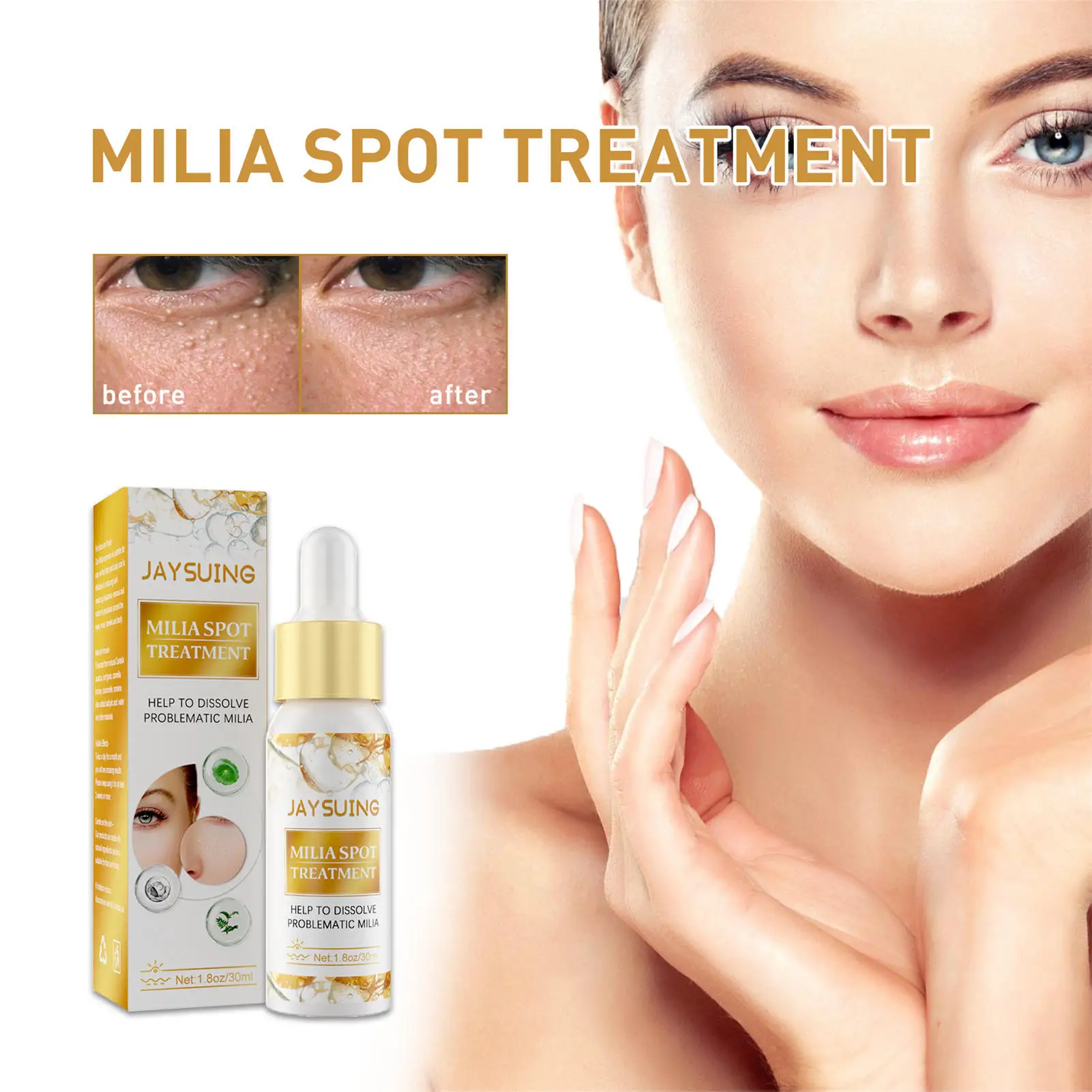 Milia Remover Essential30ml Dark Circle Serum For Eyes Dark Eye Circle Treatment Puffys Eyes Treatment Anti Ageing Eye Serum