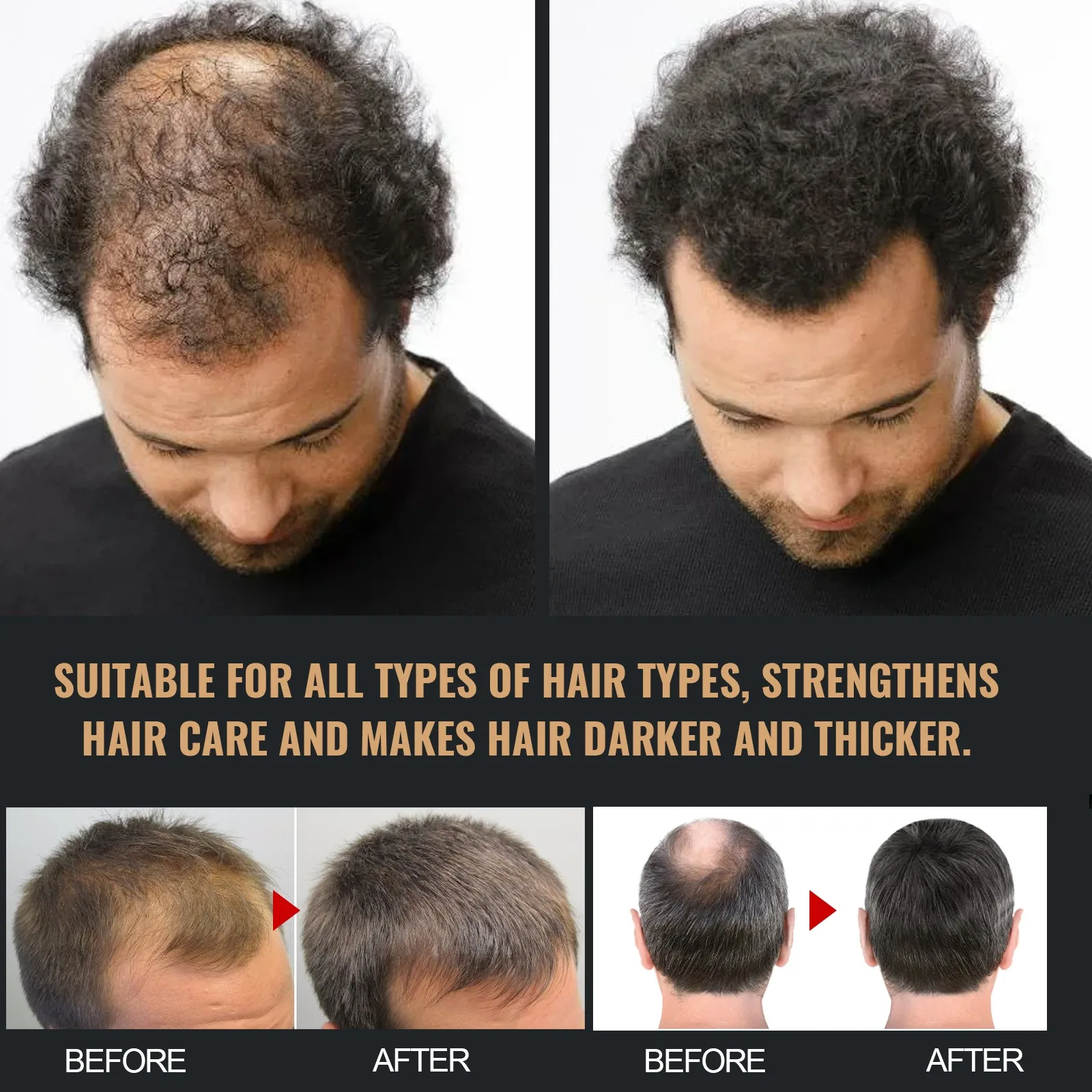 Spartan Nourish Root Men Shampoo Hair Fall Mild Stimulating Anti Volumizing Hair Regrowth Treatment Strengthen Hair Root 100ml