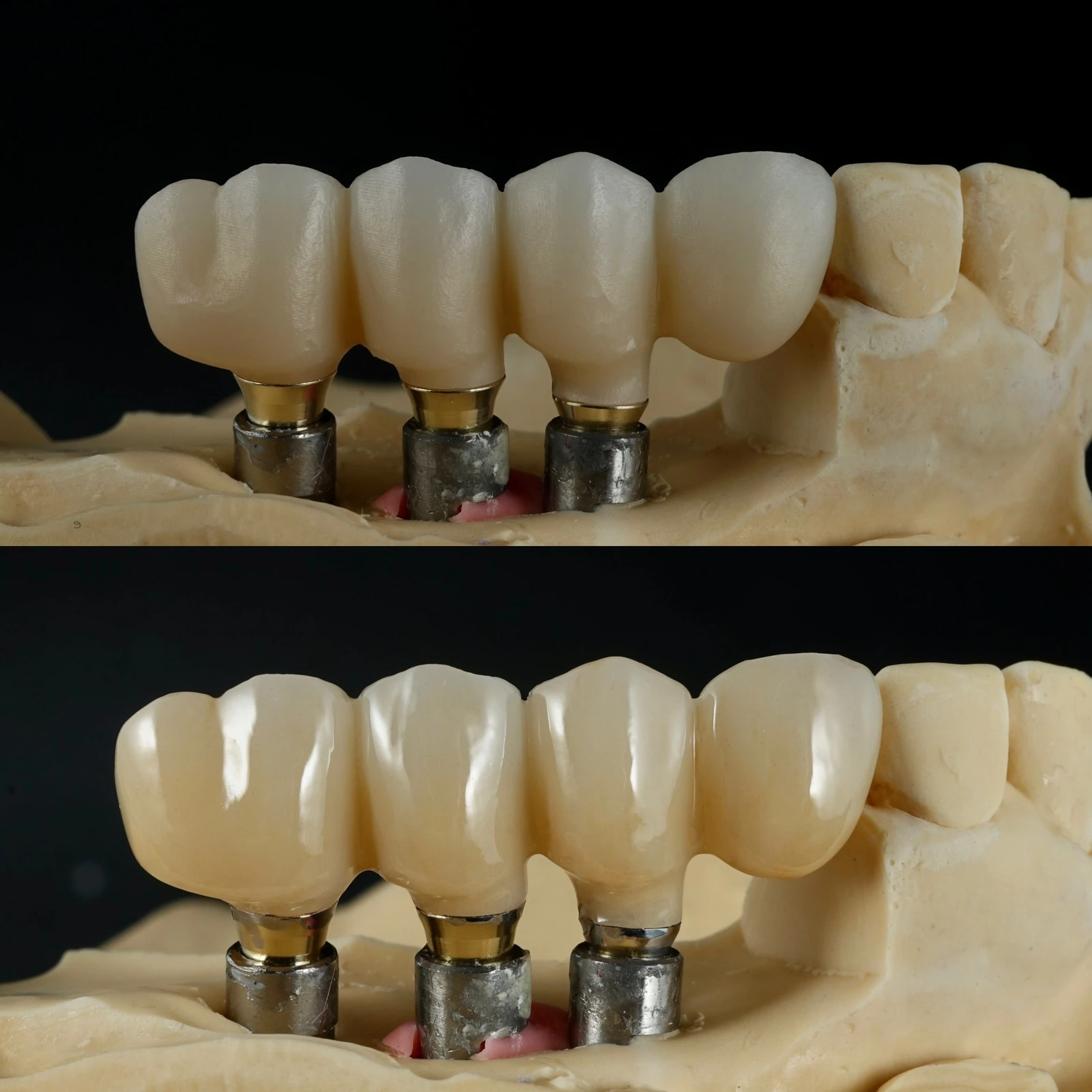 คุณภาพสูง Zirconia บล็อกเซรามิควีเนียร์ Zirconia Crowns 5D หลายชั้นทันตกรรมวัสดุ