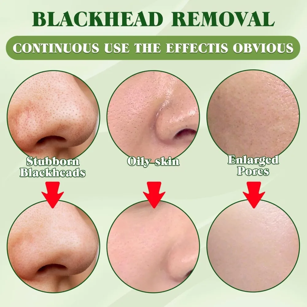 15 Pack Charcoal Blackhead Remover Nose Strips Peel-Off Pore Cleansing Strips Nose-Shaped Design for Enhanced Fit Suitable for All Skin Types