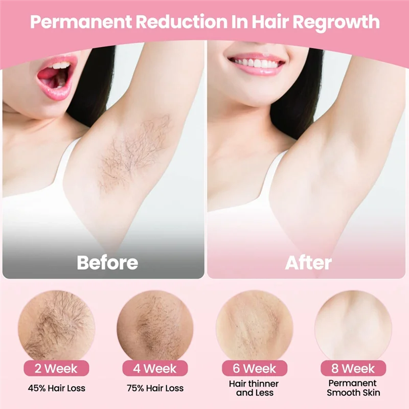 AA20-Portable Hair Removal For Women Painless Hair Removal For Home Use Portable Hair Removal Device For Home Use