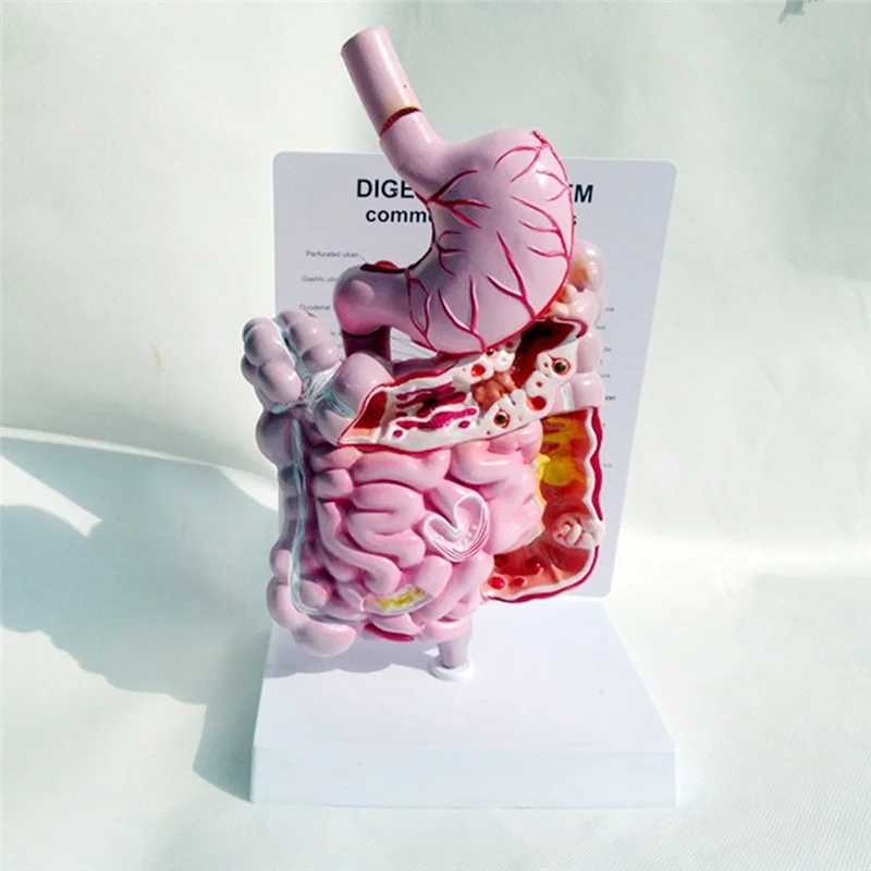 نموذج تشريح الأعضاء الداخلية البشرية الجهاز الهضمي المعدة الأمعاء Cecum Rectum نموذج هيكل الثنائي