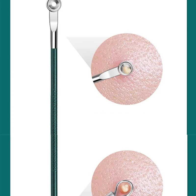 Acne-naaldcelklemset voor het verwijderen van mee-eters, schrapen, sluiten van de mond en het knijpen van acne-gereedschappen met pincet