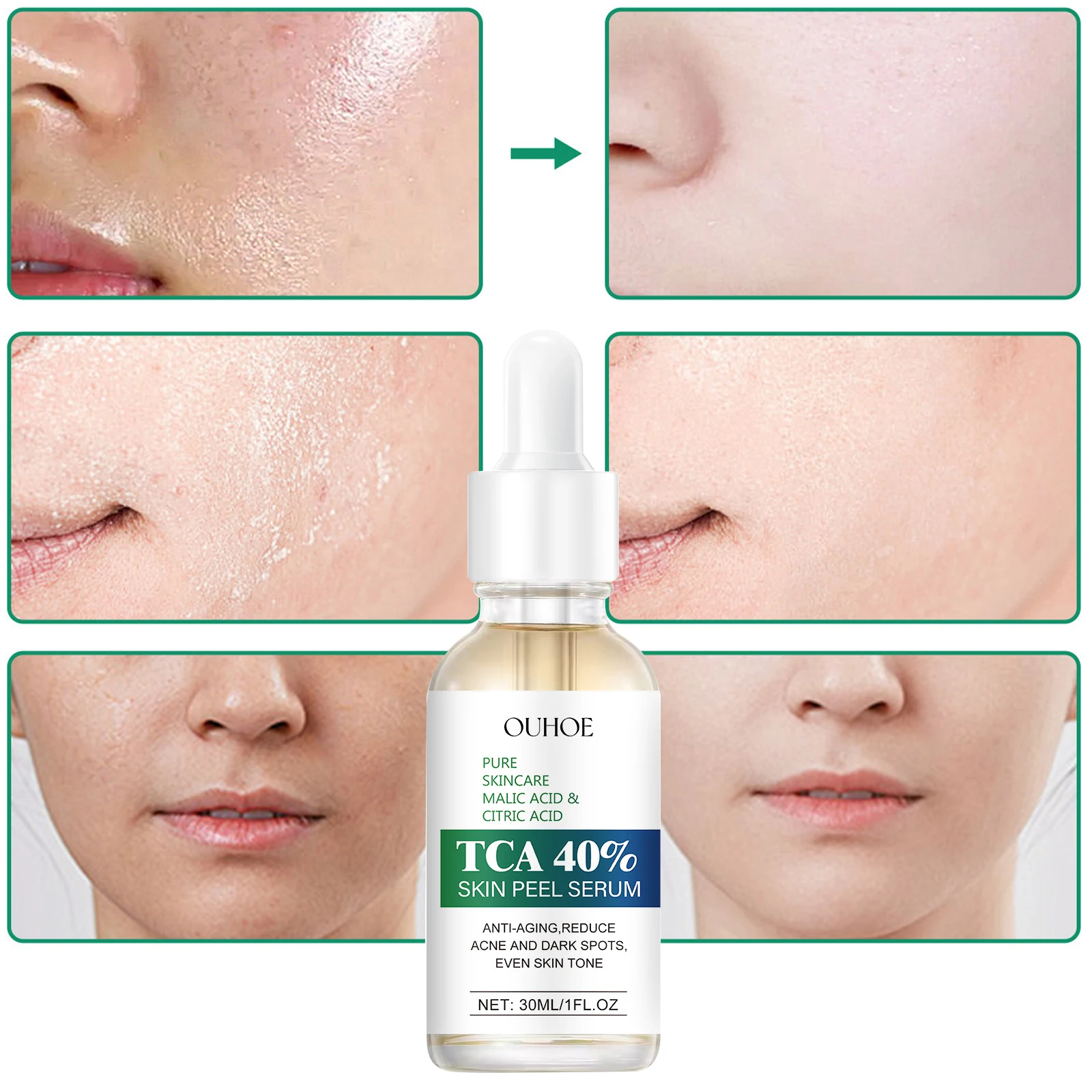 Esencia facial antiarrugas, suero facial hidratante, reafirmante, alivia, blanquea, ilumina los poros, repara la piel