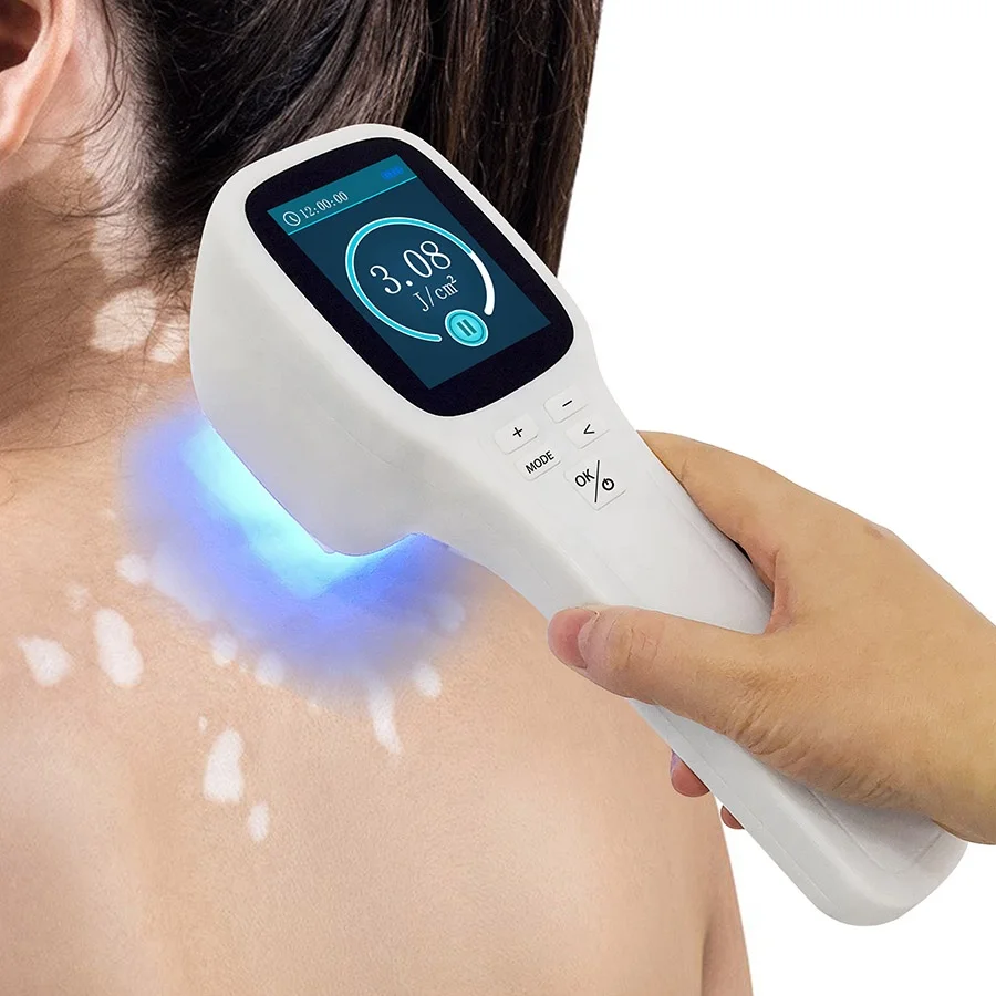 ZJZK professional 308nm excimer phototherapy device for vitiligo psoriasis treatment no side effects