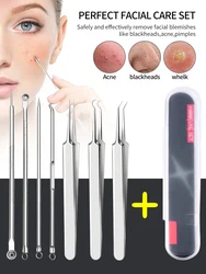 Acne Needle 7-Piece Blackhead Removal Kit,Acne Extractor, Acne Cleaning Kit Rugged Stainless Steel For Both Men And Women