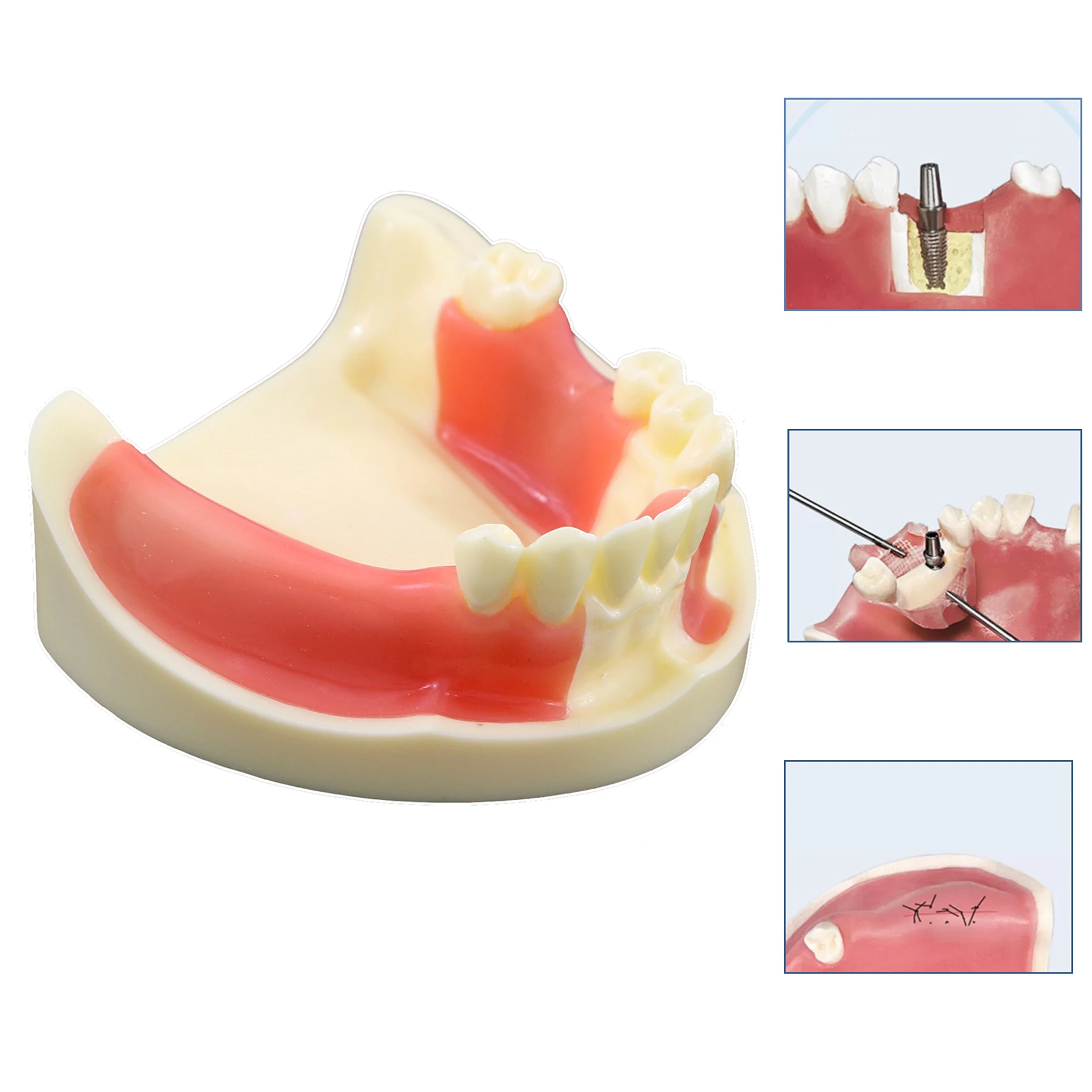 Dental Model Dentistry Implant Practice Training Model For Cutting Implant And Suturing Practice with Cancellous Bone Dental Lab