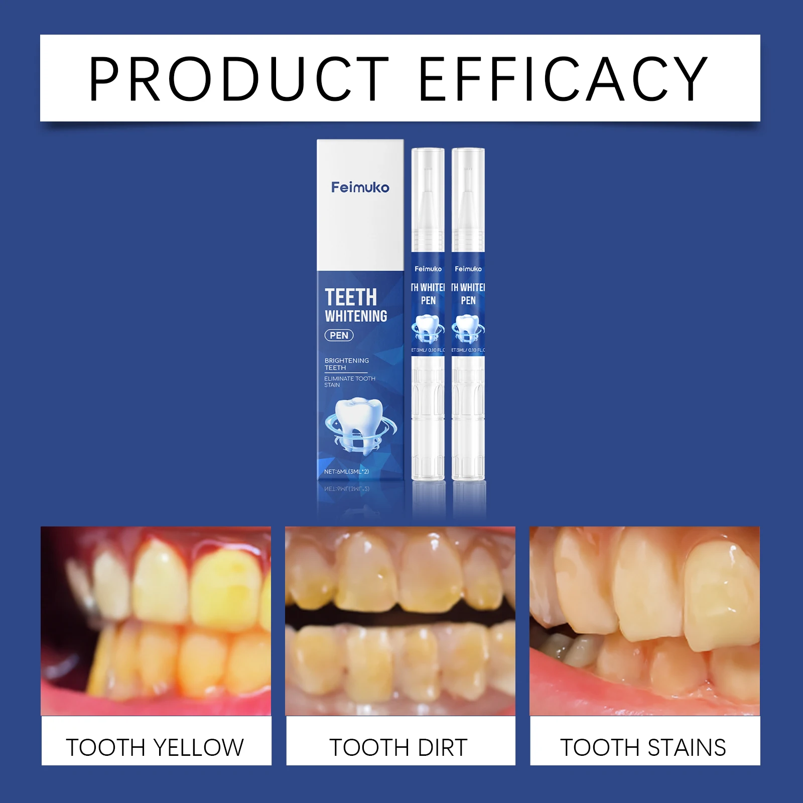 Feimuko Caneta de clareamento - Teeth Whitening Pens avaliação e preço