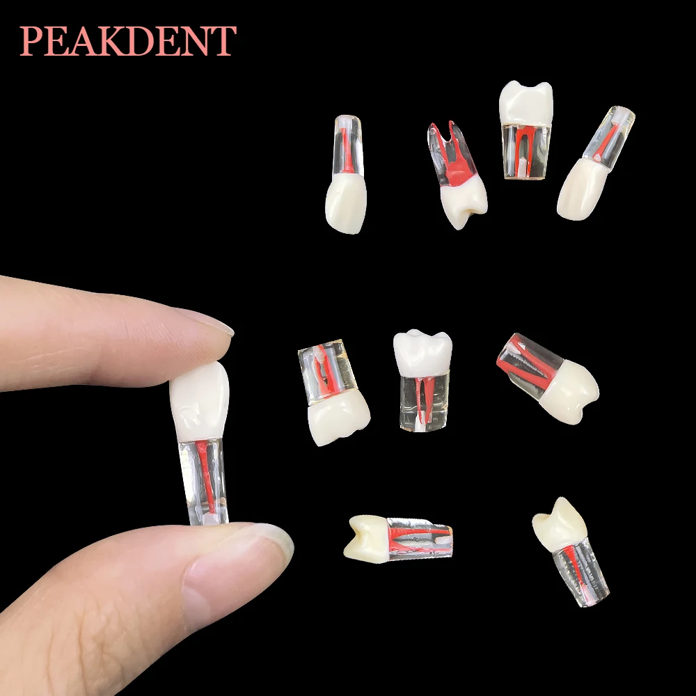 Dentaire RCT Endo Dents Modèle Endodontique, Canal Radiculaire Nuit, Pulpe Cavité Résine, Étude Pratique, Entraînement Endodontique, M8006, 1 Pc