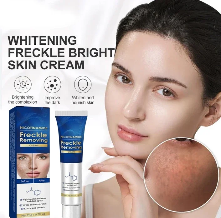 

Dark Spot Remover for Face Removing Freckle Chloasma Senile Plaques Sunburn Cyasma Chorioplaque Freckle Cream