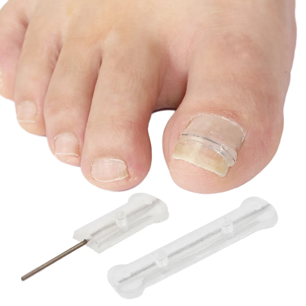 Corrector de uñas de Gel de sílice de aleación de titanio, herramientas para tratamiento encarnado, alambre profesional compacto, uso diario, pequeño, 10 Uds.