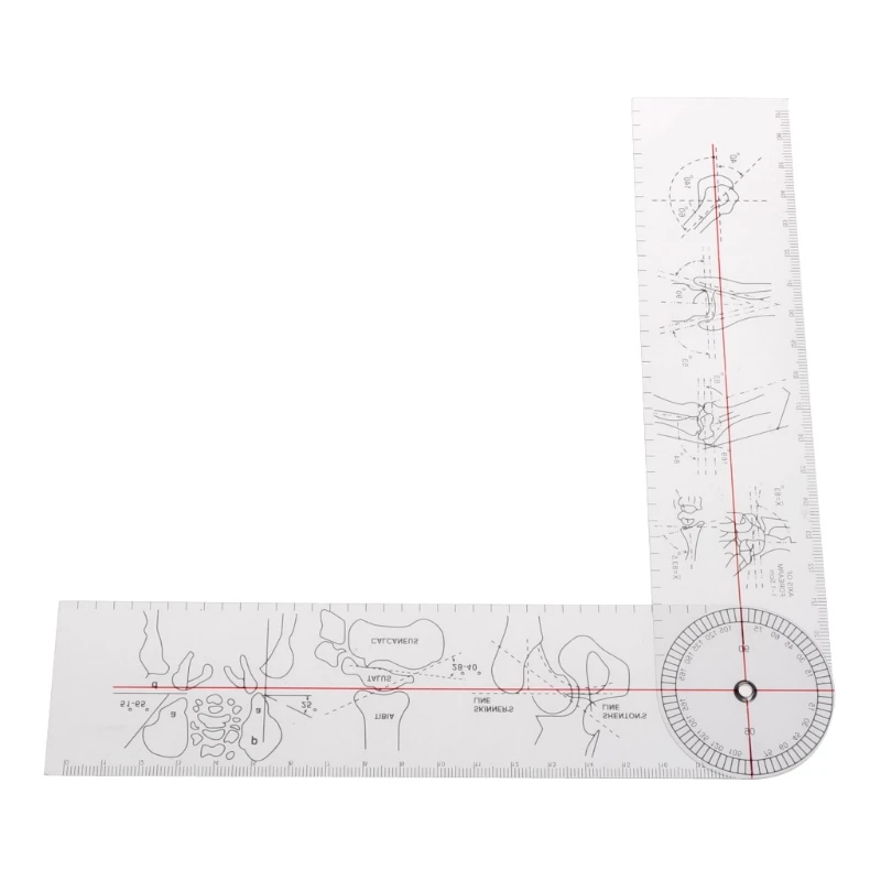 1185 Professional Portable Orthopedic Medical Measuring Ruler