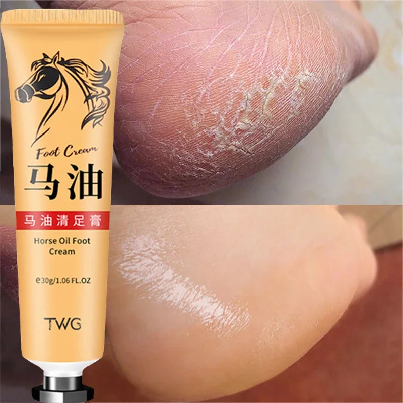 Horse Oil Cream Anti Crack Foot Cream Heel Cracked Repair Smooth Removal Dead Skin Callus Anti-Drying Hand Feet Skin Care 30g