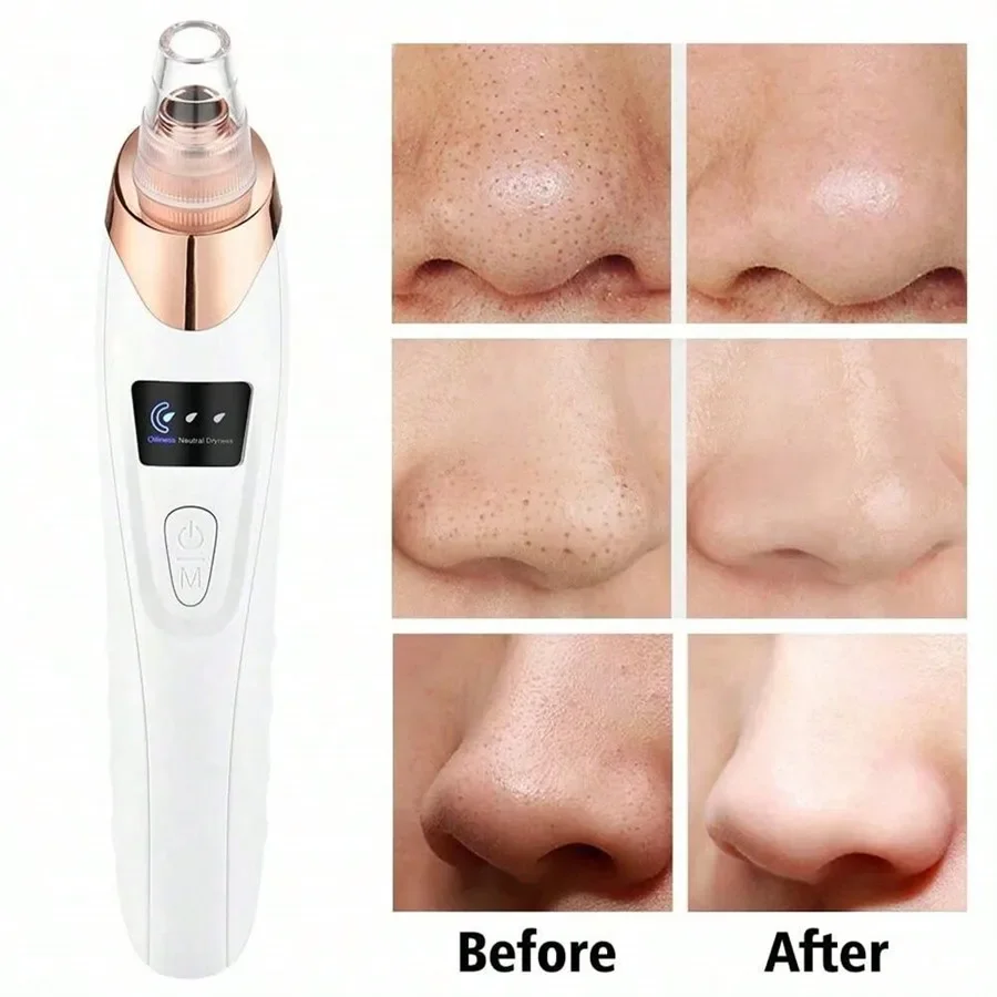 

Electric Facial Skin Care Pore Removal Cleanser Vacuum Acne Removal ,Women Blackhead Remover Pore Vacuum,Facial Pore Cleaner