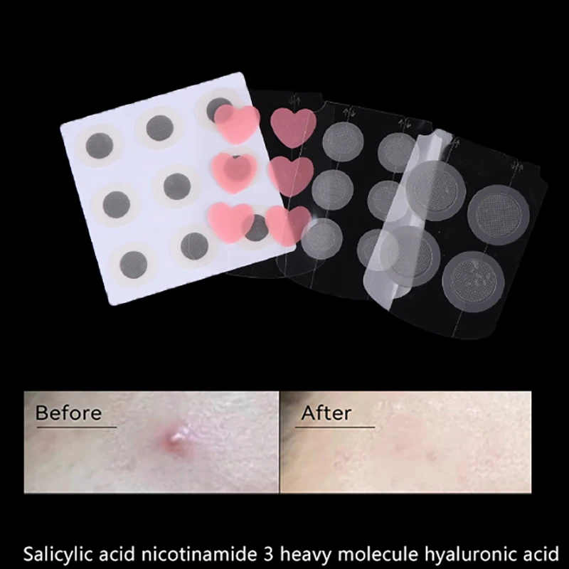 4/6/9 Stickers Tiny Needles Anti Acne Pimple Removal Soothing Skin Face Patches Master Healing Blemish Treatment Sticker Zits