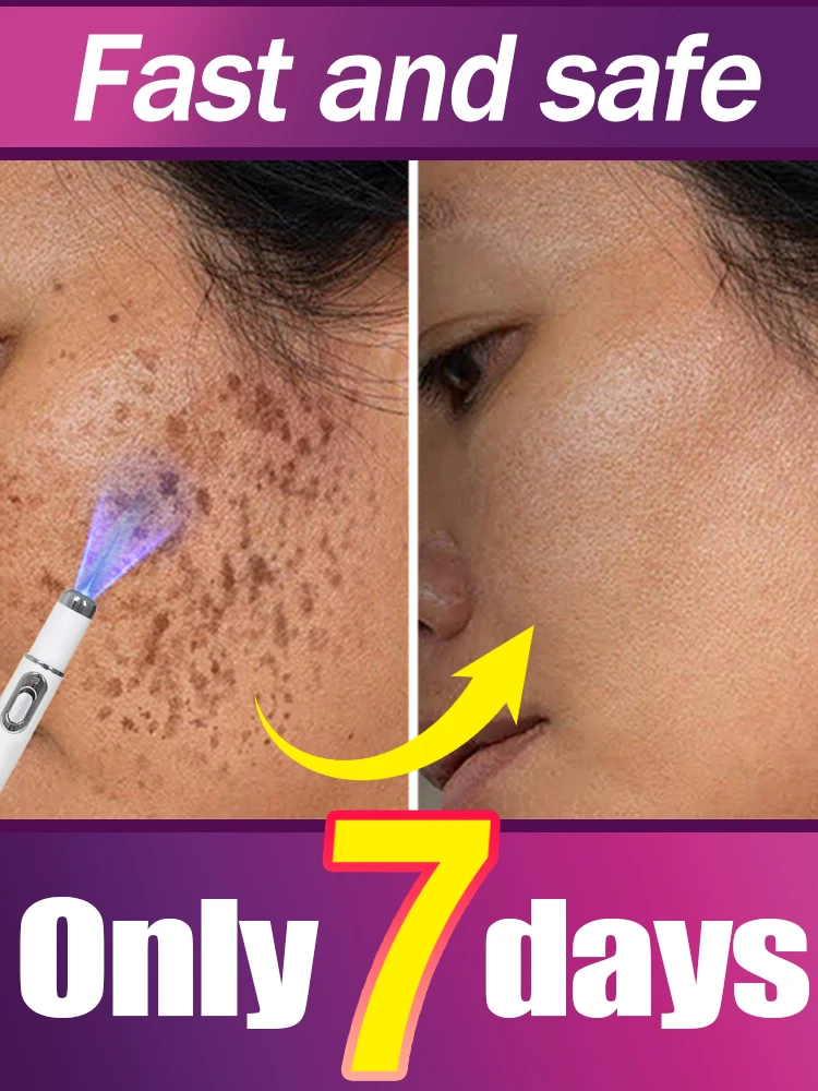 laser repair dark spot hot sale