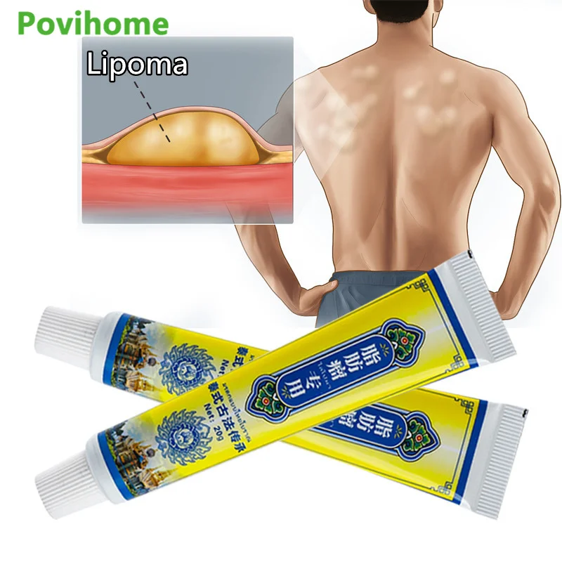 

20g Lipoma Removal Cream Effectively Reduce Inflammation Treat Subcutaneous Lumps Fat Shoulder Remove Anti-swelling Ointment