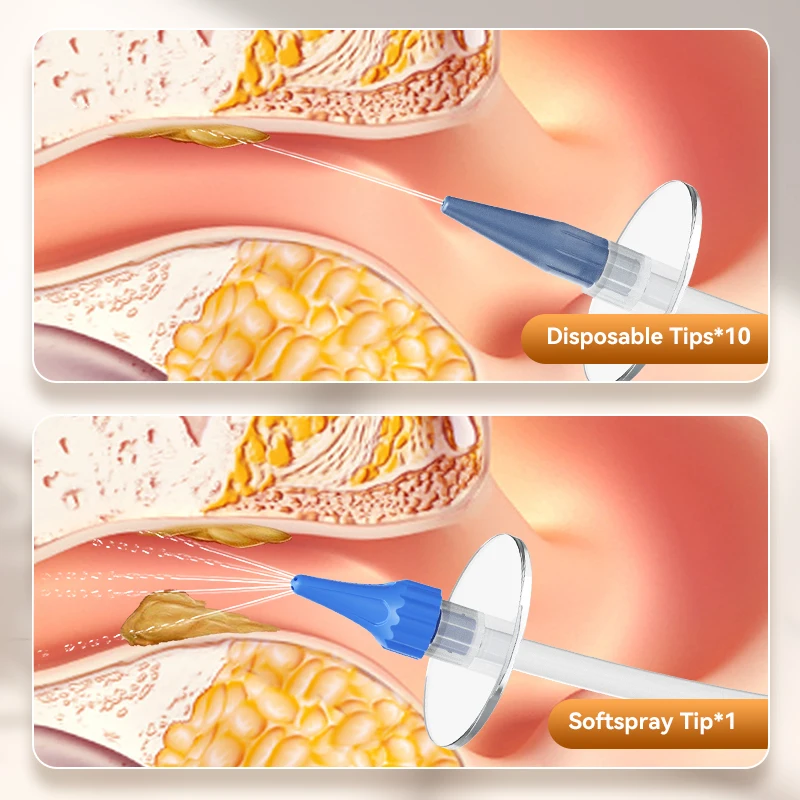 Ear Wax Removal Manual Ear Irrigation Flushing System EarWax Clean Tool Safe and Effective Ear Water Cleaner Kit Ear Cleaner