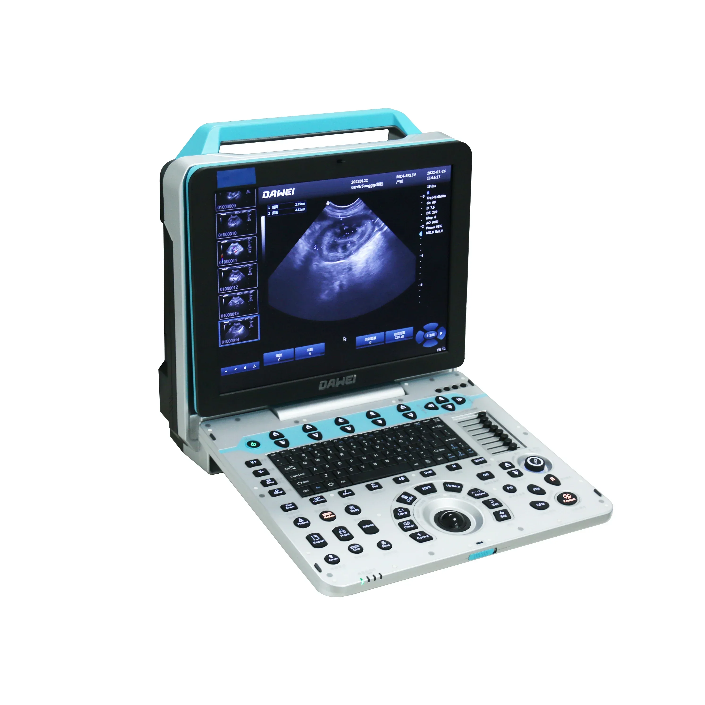 Dawei Veterinary Equipment Suppliers Portable Veterinary Ultrasound Dog Prenancy Scanner