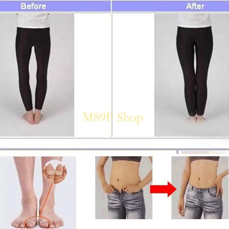 M89F 자기 발가락 고리 2X 연소 지방 유지 피트니스 발가락 반지 실리콘 발가락 링 선물