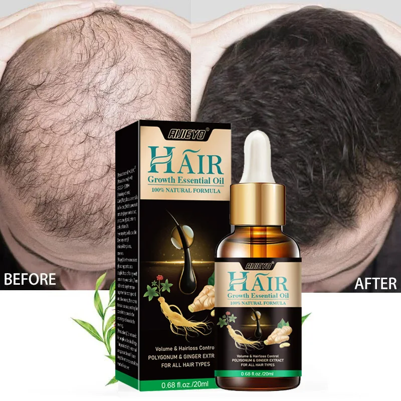 2023 Biotin Fast Hair Growth Oil  Regrowth Serum  Thinning Treatment   Liquid Anti- Loss for Women & Men