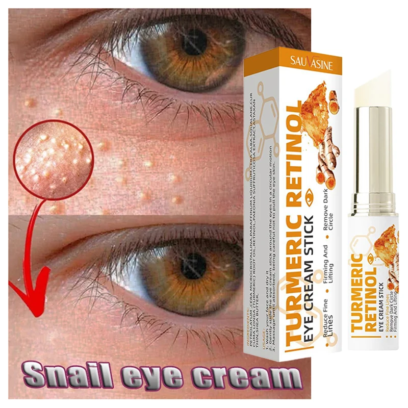 Crema de eliminación de gránulos de grasa para ojos, palo antihinchazón, reafirmante, antiinflamatorio, desvanecimiento, reparación de líneas finas, barrera de la piel, cuidado de la piel de los ojos