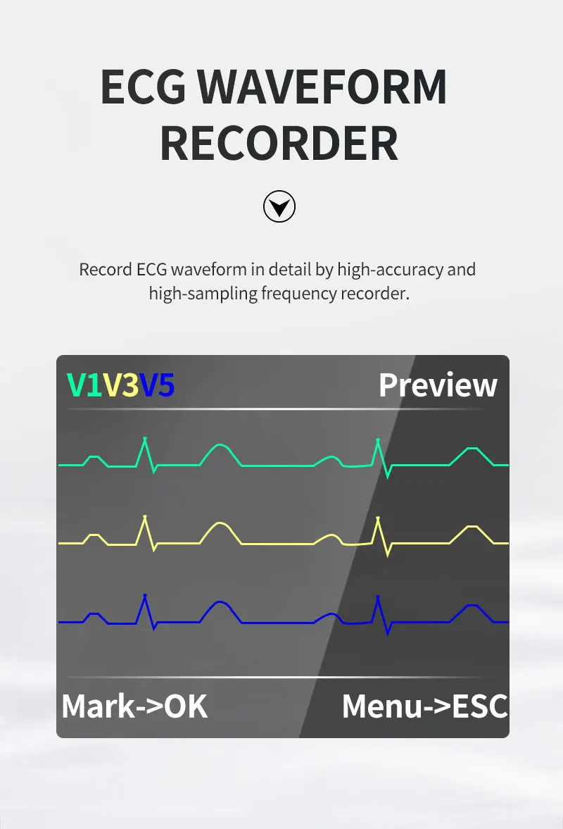 CONTEC Offical TLC9803 Genuine 3 Channels ECG Holter Monitor System 24-Hour Dynamic EKG Recorder for Heart Rate Monitor