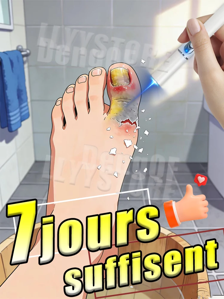 

Лазерная ручка восстанавливает ваши ногти в здоровое состояние