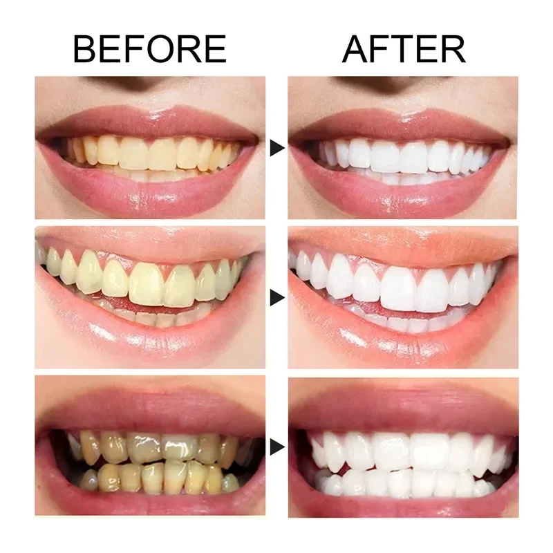 Mousse Toothpaste Cleaning Teeth Bright White Repair Anti Sensitive Removes Bad Breath Freshens Breath Tooth Care Product