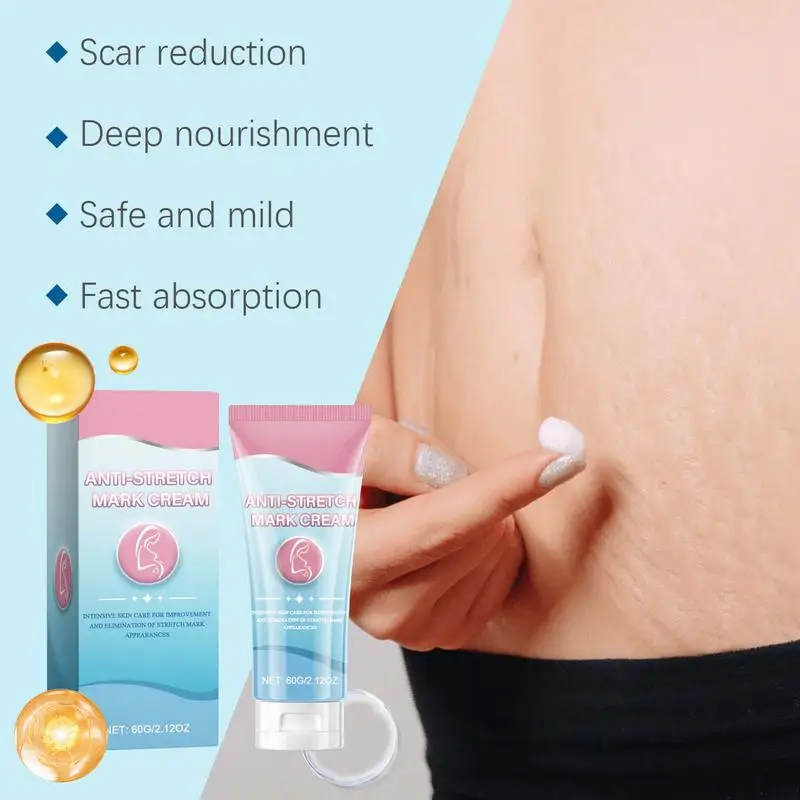 Krim penghilang Stretch Mark 60g, krim perawatan kulit kehamilan, krim penghilang bekas luka dan perut Anti gores, penghilang alami untuk