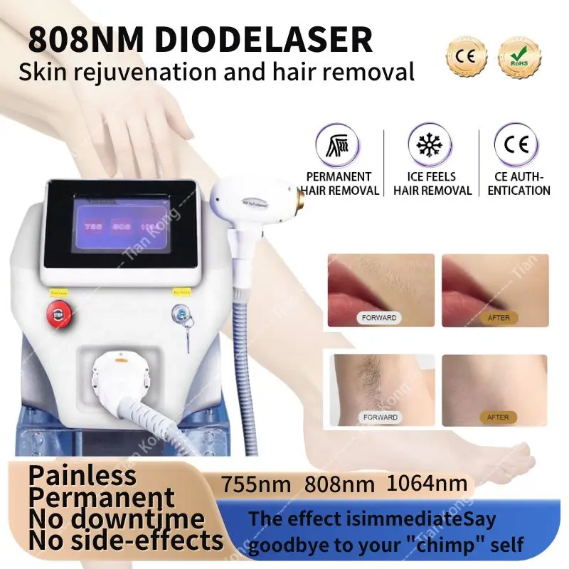 2023 ultima macchina per la depilazione del punto di congelamento indolore permanente del Laser nanodiodo da 2000W con 808nm 755nm e 1064nm tre Wav