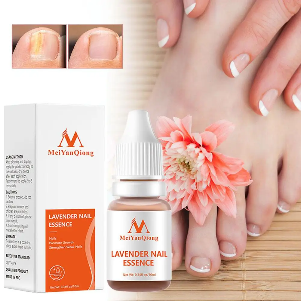 Lavender Fungal Nail Treatmentessential Oil Nail Art Tools & Nailsgrow Care Nail Foot Healthy Treatment Promote V9s1