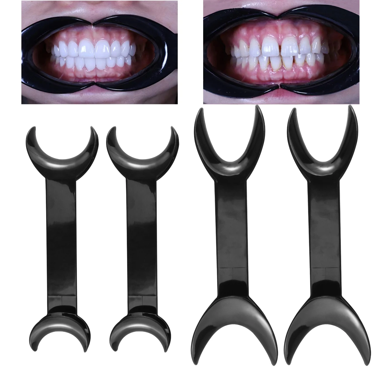 4 PCS Dental Mouth Opener Cheek Lip Intraoral Retractor T-Shape Double Head Large Size Orthodontic Tool Spreader for Lip Mouth