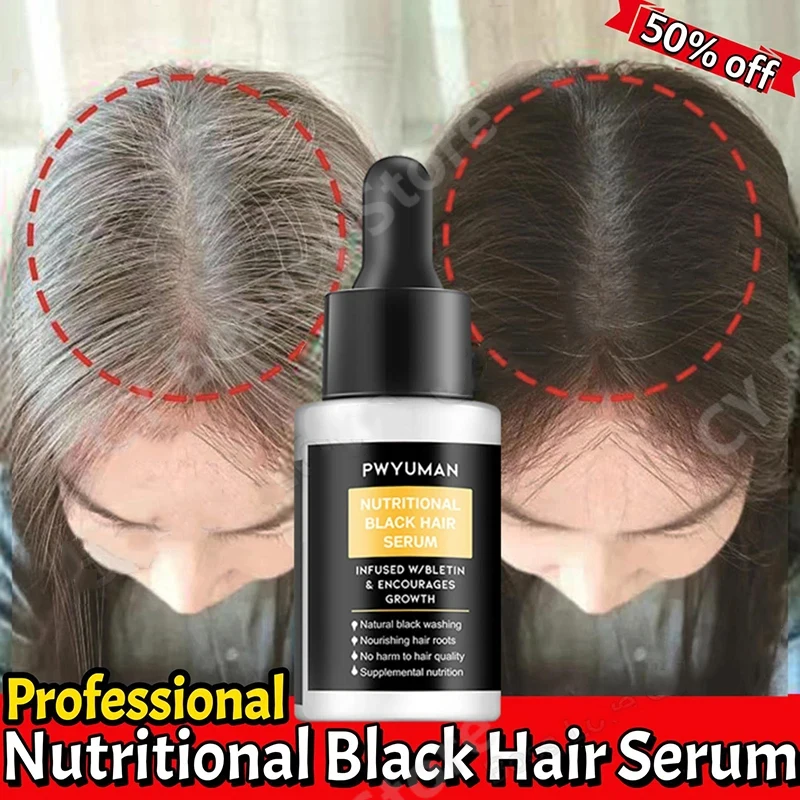 

Gray White Hair Serum Lasting White To Black Natural Color Hair Growth Oils Fast Regrowth Anti Hair Loss Beauty Health Women Men