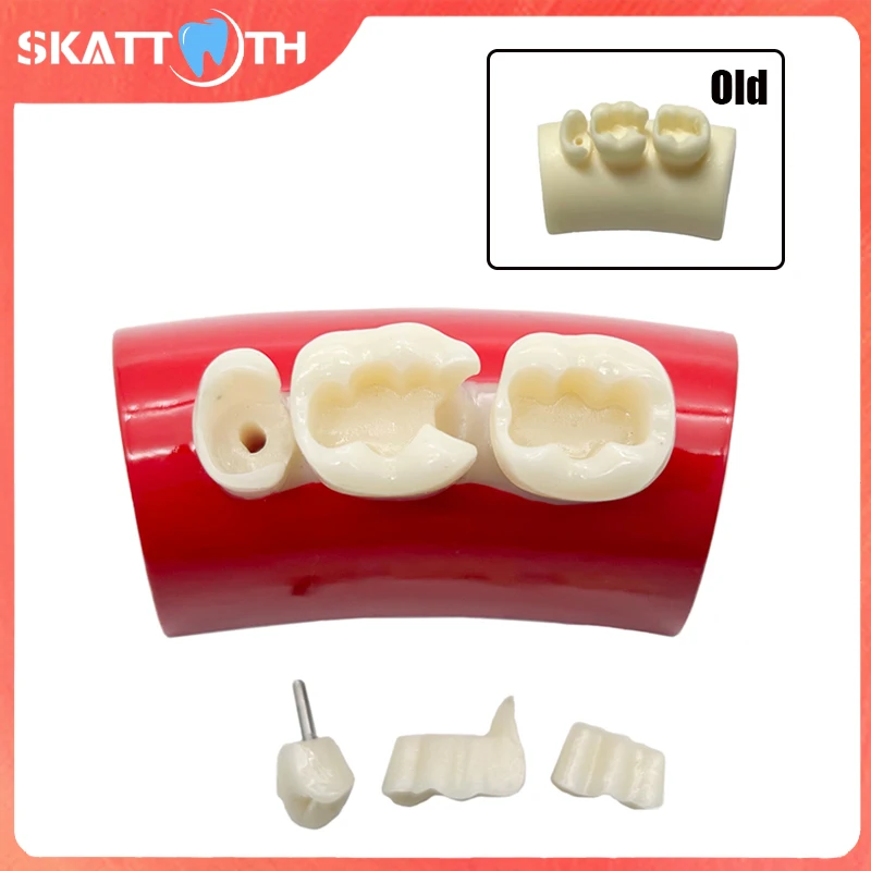 1Pcs Dental Inlay Exercise Model Block Filling Exercise Typodont Model Resin Materials Oral Filling Model Dentist Teaching Study