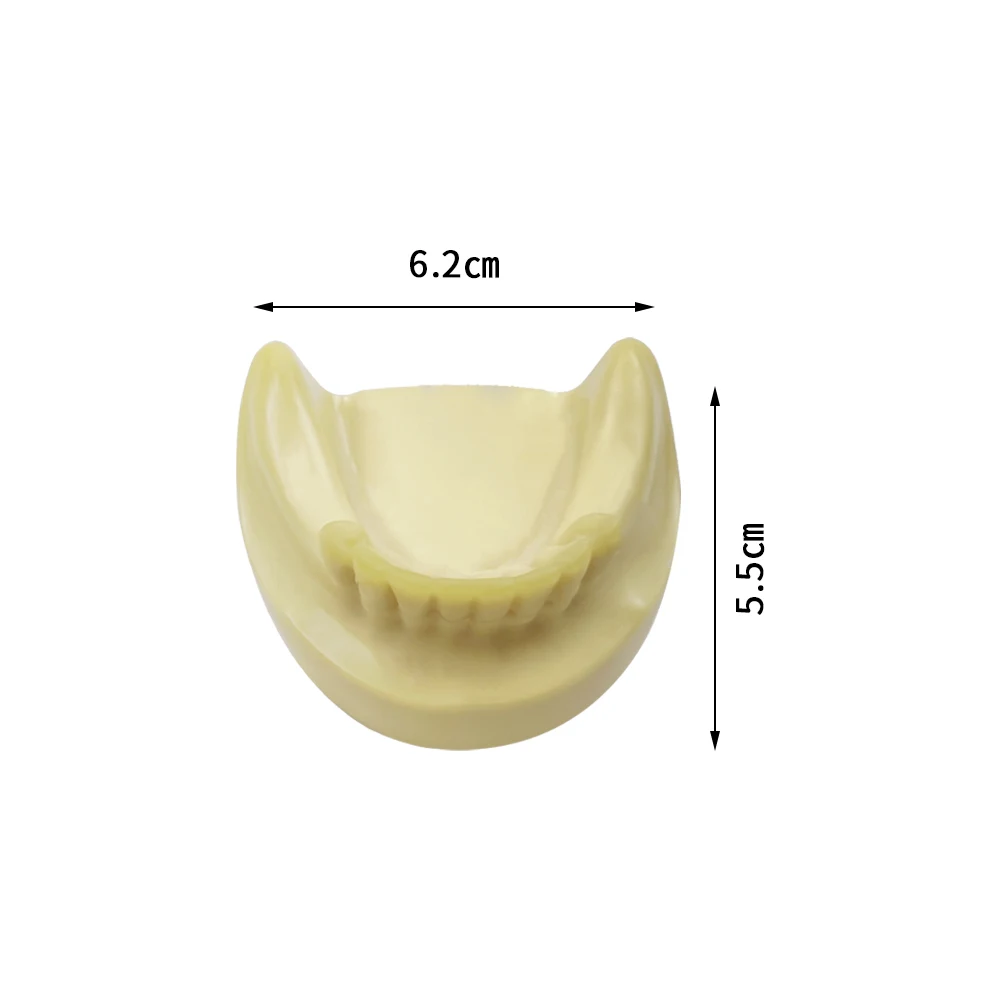 Tandheelkundige Opleiding Model Tanden Implantaat Oefenmodel Met Ontbrekende Tanden Tandheelkundige Producten Voor Tandarts Leerlingmodellen