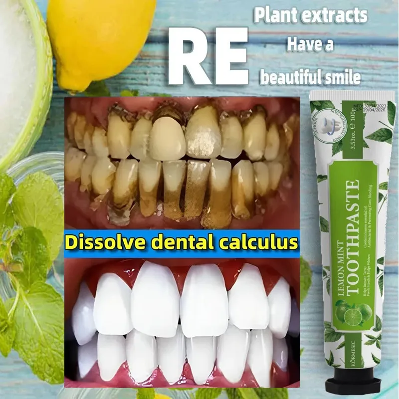 Dentífrico removedor de cálculo dental, remover os dentes amarelos, mau hálito, placa de limpeza, mancha dentária, clareamento, prevenção da periodontite