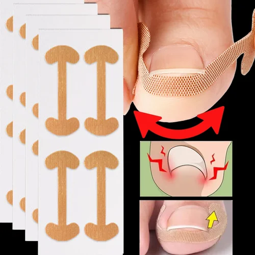 Imagen 2 del producto 100 Uds tiras correctoras de uñas encarnadas adherencia duradera pegatinas correctoras de uñas impermeables elasticidad cuidado de los pies herramientas de pedicura