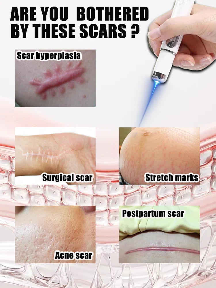 Paniyanicastitute FestivallS: SSs BonbonSFestivall Festivall Festivall Festivall Festivall