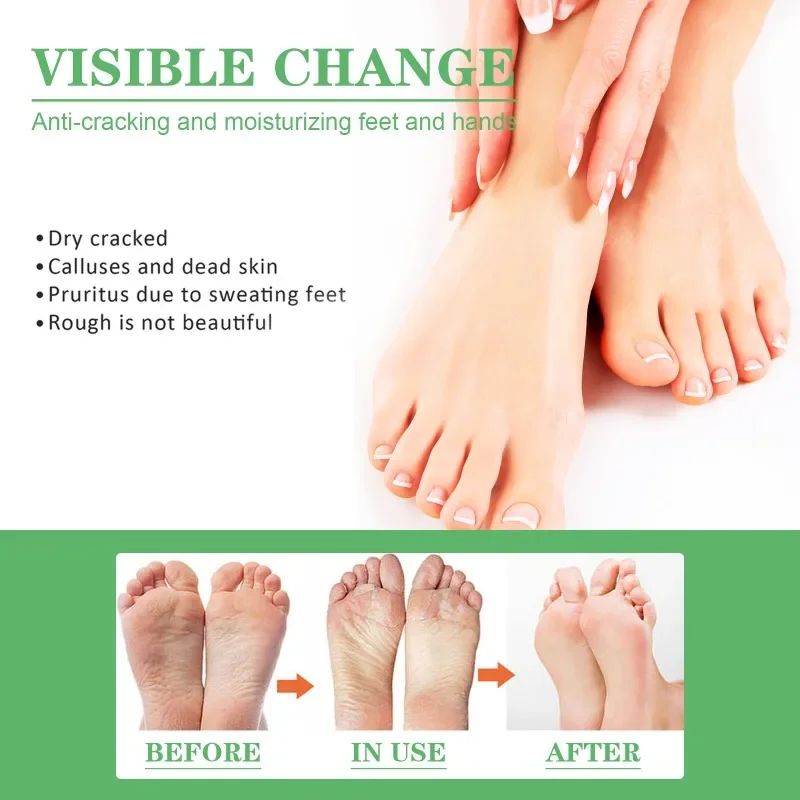 Sdatter Chapped Protective Hand Foot Cream Anti peeling exfoliation Repair Skin Heel Anti-Dry Crack Removal Dead Skin Moisturizi