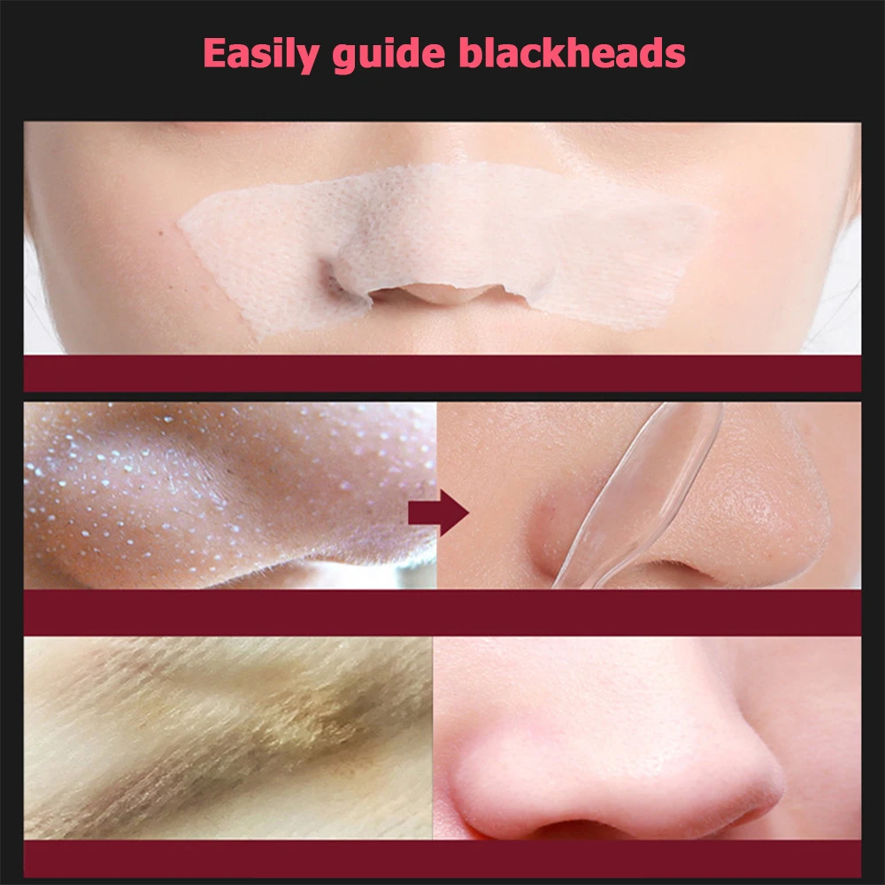 White Head Black Spots Cleaner Conductive Fluid For Facial Deep Cleansing Blackhead Pimple Remover Skin Point Noirs Extractor