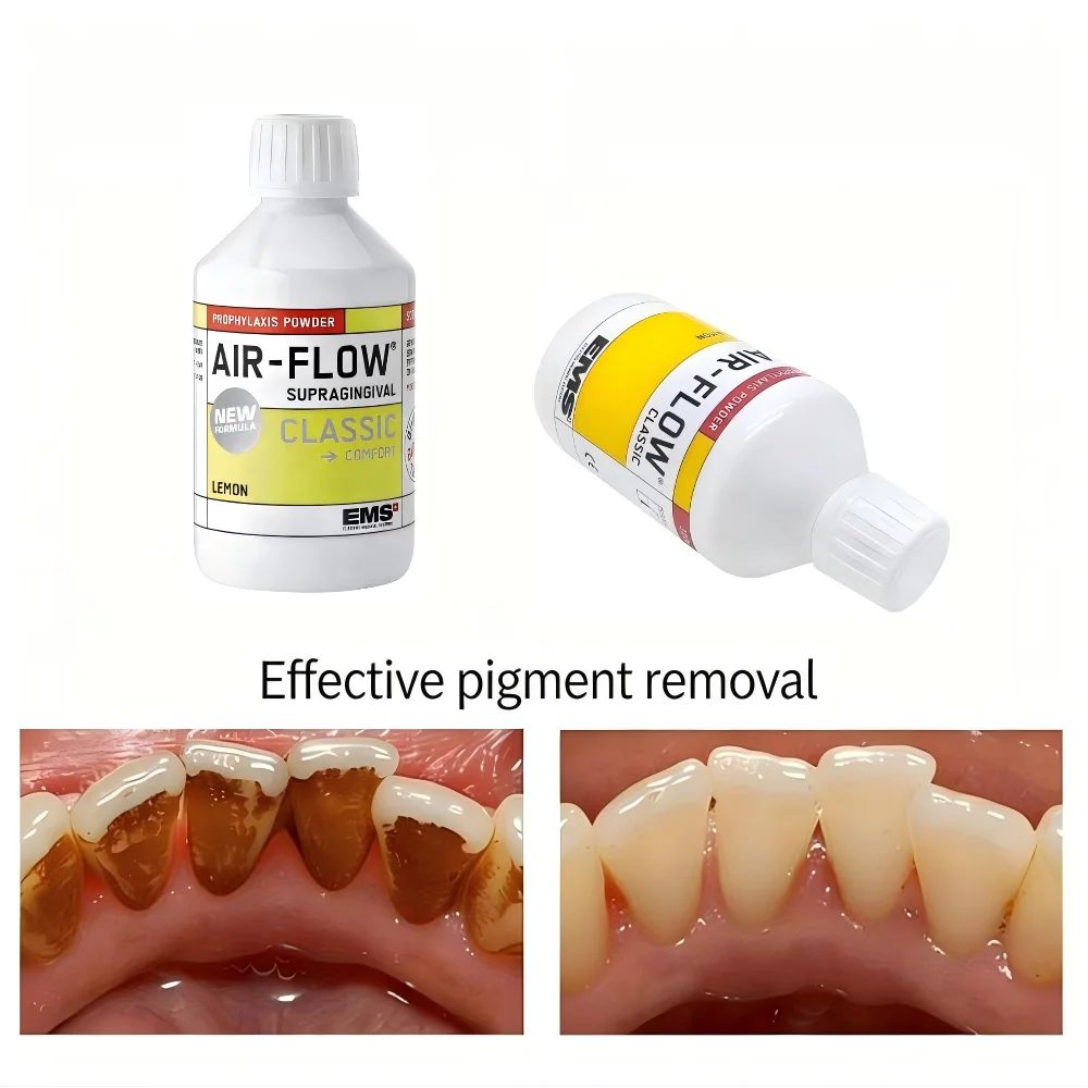 

EMS AIR-FLOW Prophy Powder Dental Air Polishing Powder Sodium Bicarbonate for Supra Gingival Cleaning Stain Removal DV048