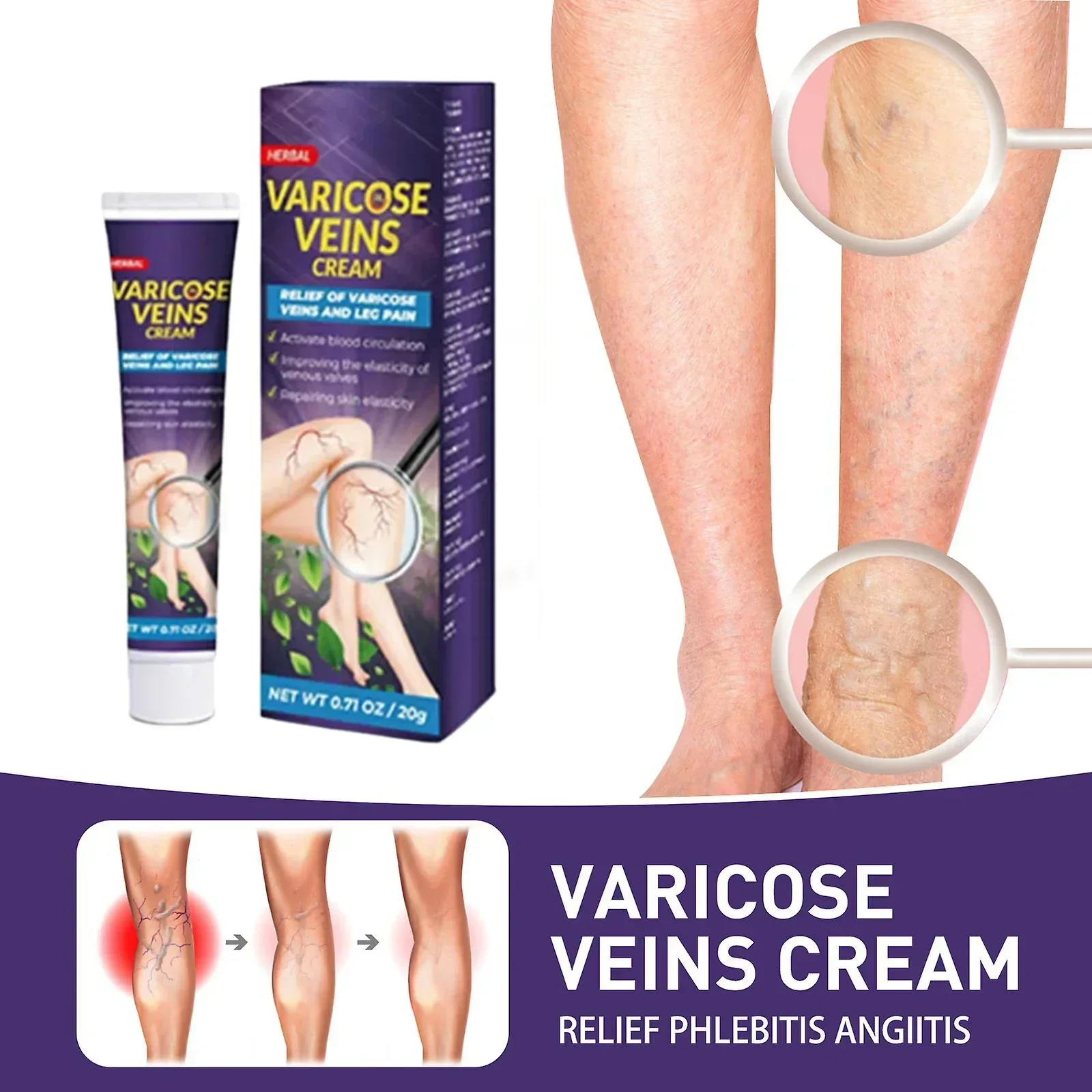 

Leg Cream for Circulation, Cooling Effect Cream for Swollen Legs and Ankles and Feet, Spider Veins