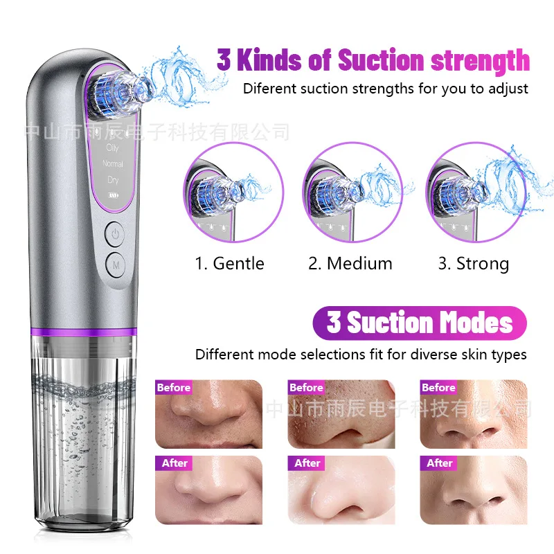 

Small Bubble Blackhead Remover Vacuum Home Use Facial Pore Cleaner Acne Removal Deep Cleansing Skin Care Beauty Instrument