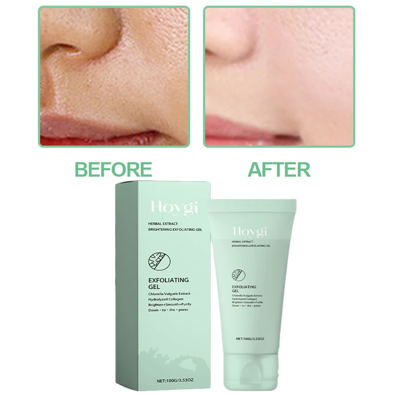 100g Peeling-Peeling-Gel für das Gesicht, Reparatur-Peelings Gesichts peeling aufhellend feuchtigkeit spendend pflegende Gesichts creme Schönheits pflege