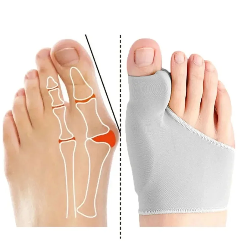 Separador de dedos de los pies Hallux Valgus Corrector de juanete ortopédico pies hueso pulgar ajustador corrección pedicura calcetín alisador