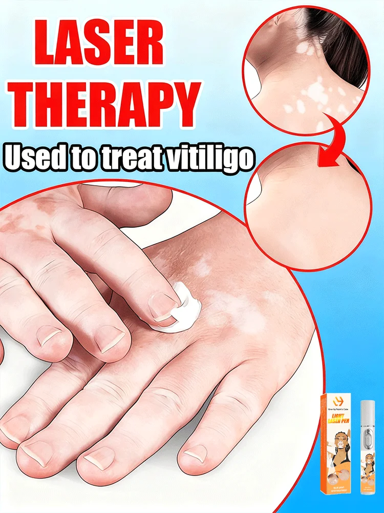 Vitiligo blue light pen,2025 hot sale,Vitiligo care tools,unisex,Generation-2,Combination Set Meals